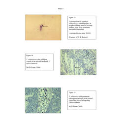 Histopathology - Plate 5 - Figures 13-15 thumb