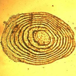 Juvenile Chinook scale