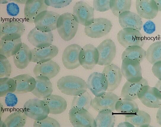 MFU 50 lymphocyte