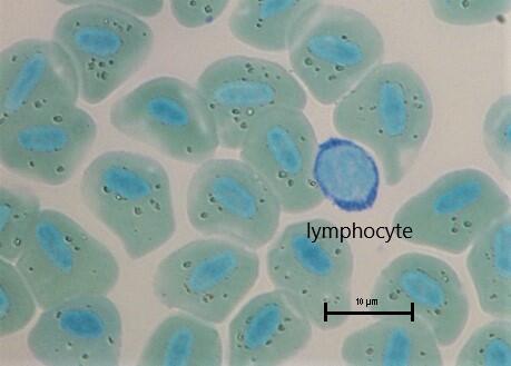 MFU 50 lymphocyte
