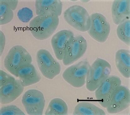 MFU 50 lymphocyte
