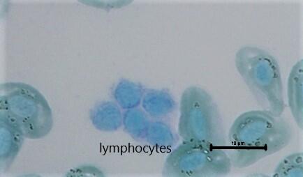 MFU 56 lymphocyte