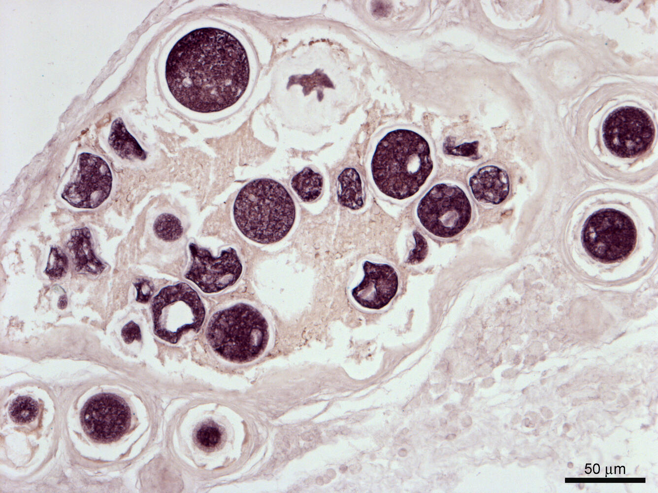 Ichthyophonus parasite