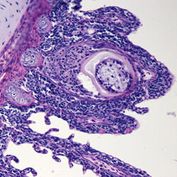Histological section of Nanophyetus salmincola metacercariae