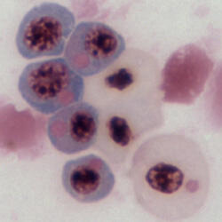 Erythrocytes from a wild, Puget Sound herring demonstrating severe VEN