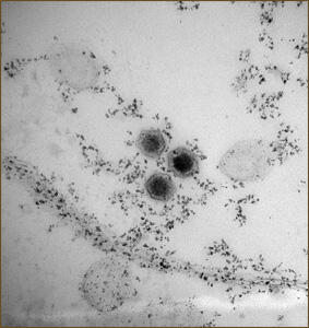 Electron micrograph of erythrocytes