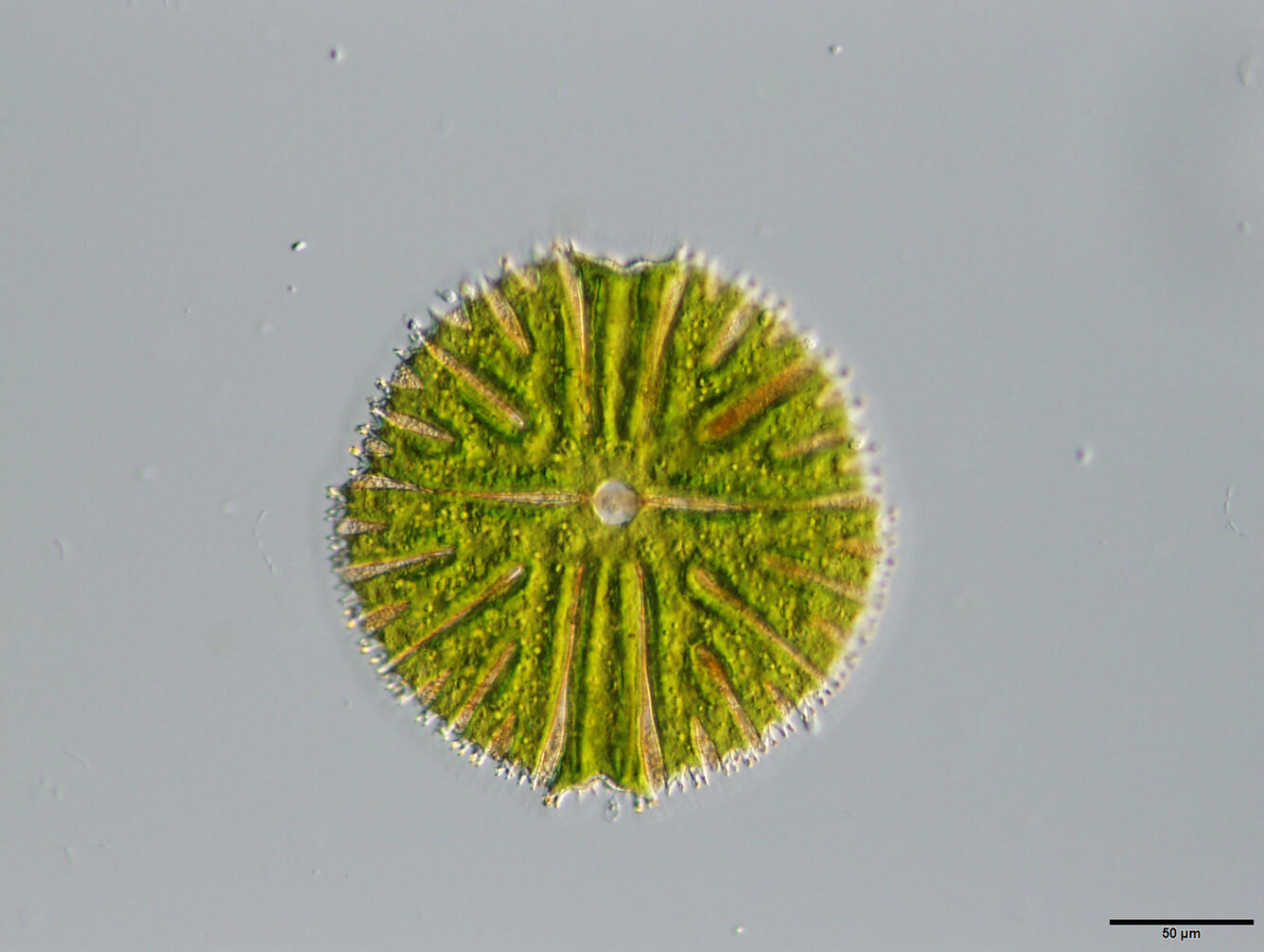 Photomicrograph of a green desmid alga resembling a holiday ornament