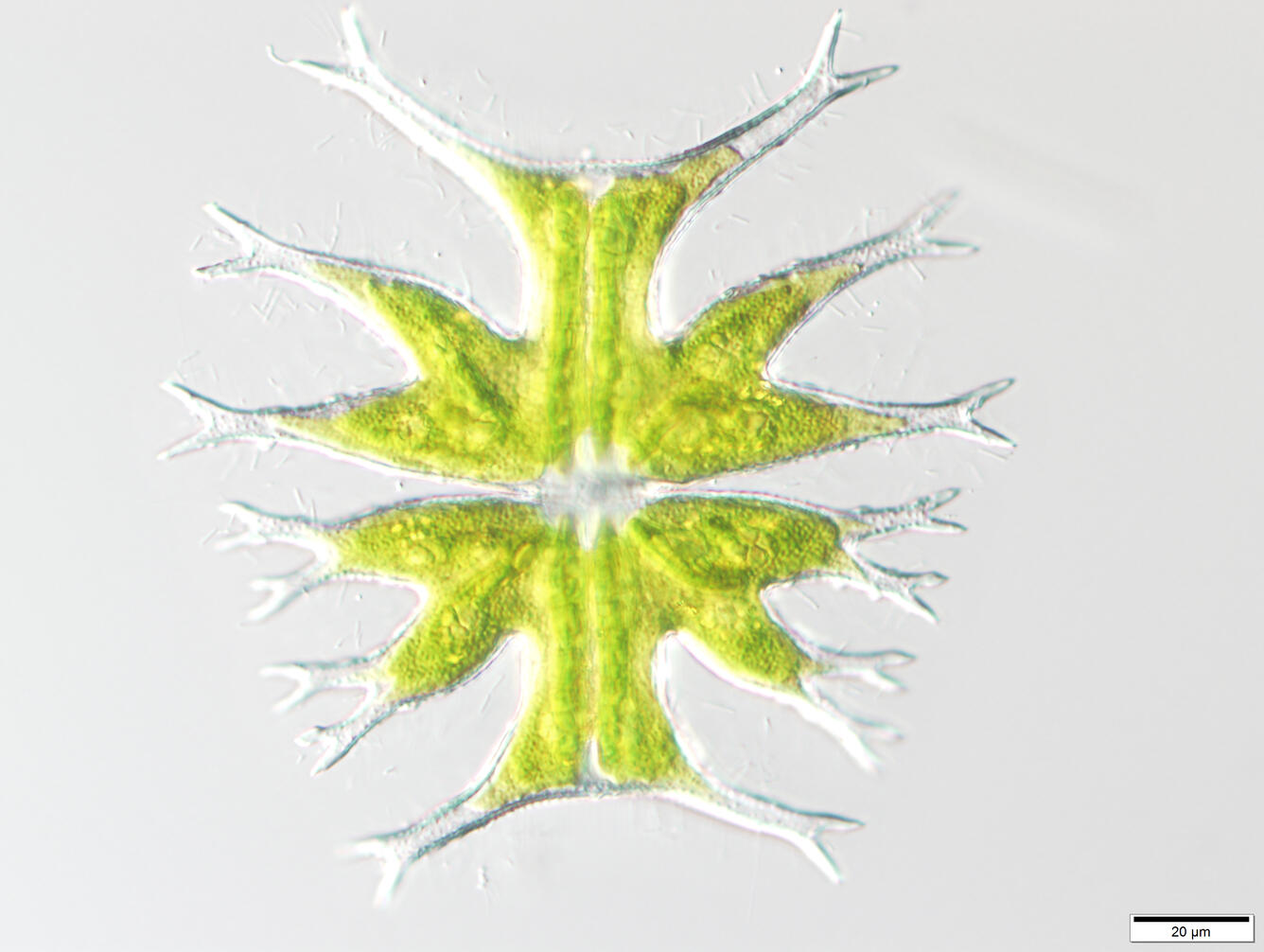 A symmetrical desmid alga that resembles a Christmas tree