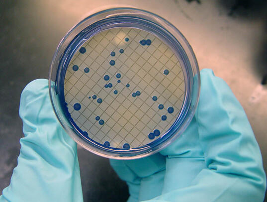 Water Quality and a Petri dish with blue organisms.