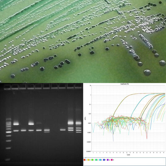 Collage of three printouts of DNA sequencing of Pathogens.