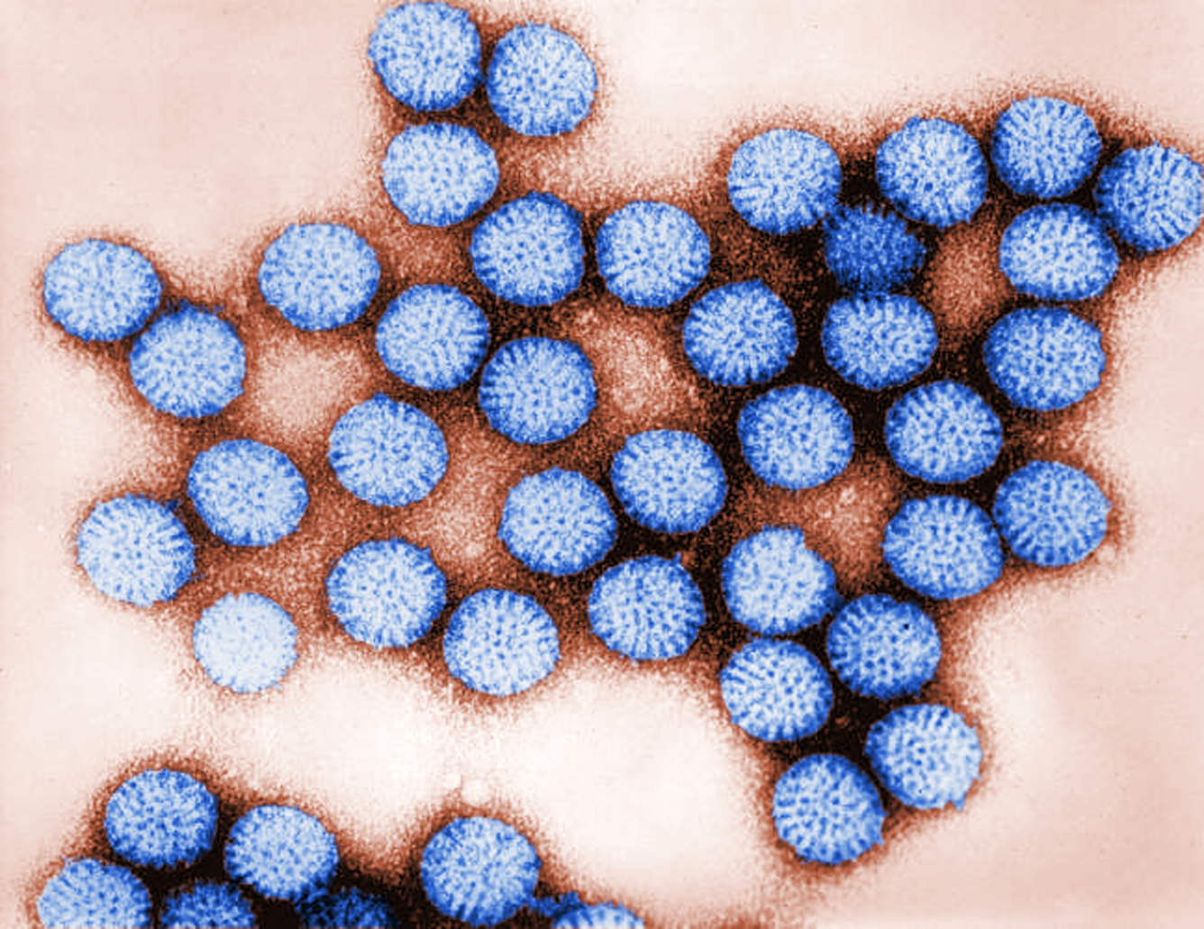 Digitally-colorized transmission electron microscopic image of intact rotavirus