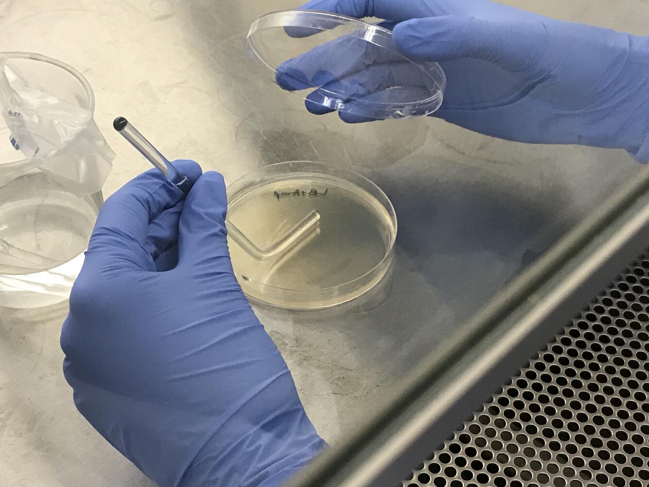 Spread plate procedure for quantitative culture Renibacterium salmoninarum