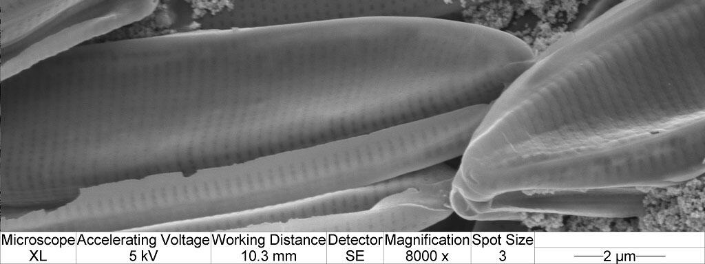 Scanning electron microscopy (SEM) image of diatoms with zinc oxide (ZnO) nanoparticles