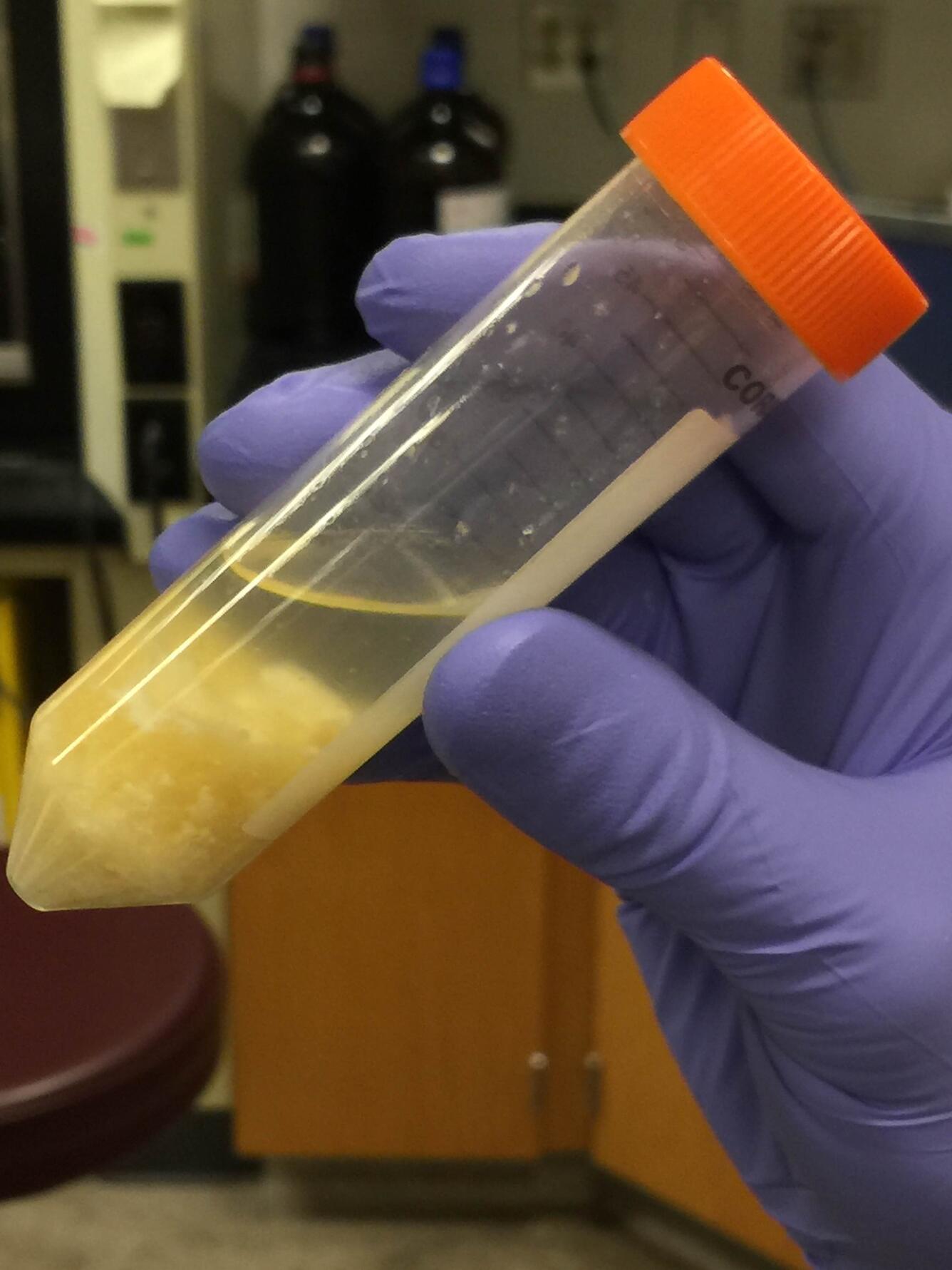 Vial containing an egg sample