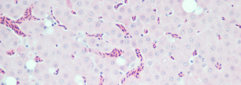 Liver vacuoles in a zebra finch (Taeniopygia guttata) treated with the neonicotinoid clothianidin