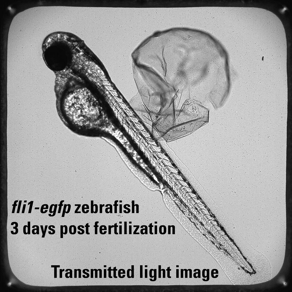 This is an example of a 72 hour post fertilization fli1:egfp zebrafish (3 millimeters long) imaged under transmitted light