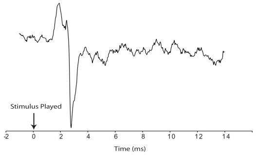 Hearing Graph results