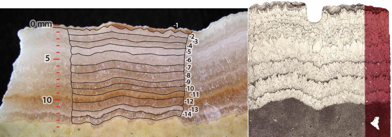 Photograph (left) and partially stained photomicrograph (right)