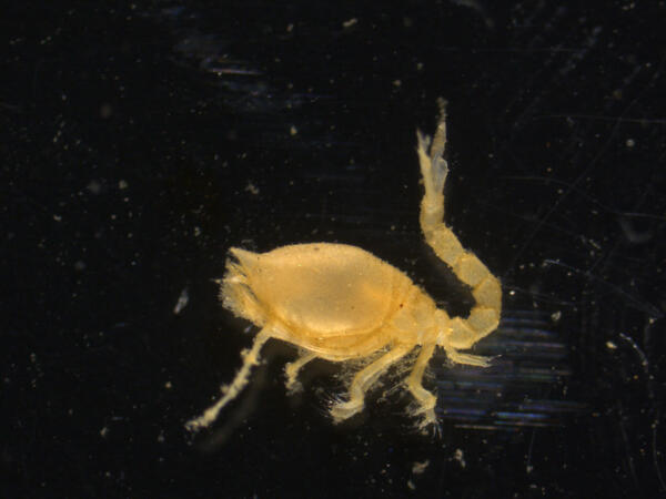 A microscope view of a small animal on a black background