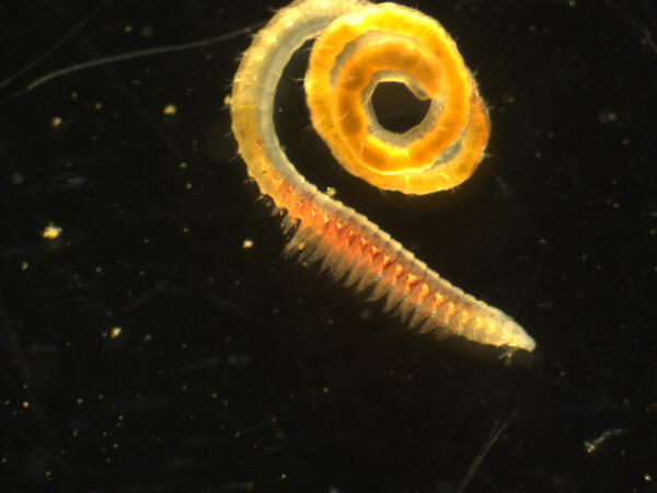 A micropscopic view of a worm on a black background