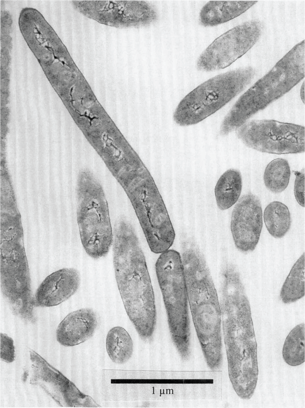 Black and white image of gray spaghetti-like filaments of bacteria on a white to light gray background