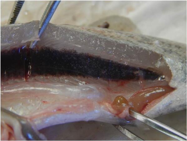 Kidney of a steelhead with heavy N. salmincola infection