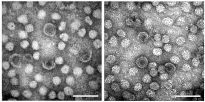 Transmission electron micrographs of complete hepatitis B viral particles.