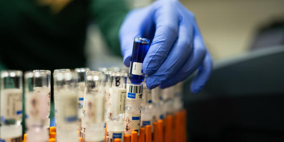 A scientist picks up a sample from a tray of samples in a lab.