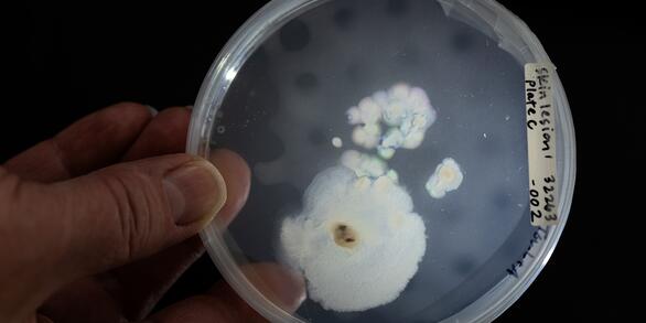 A scientist in a lab holding a salamander skin sample under a light for investigation.