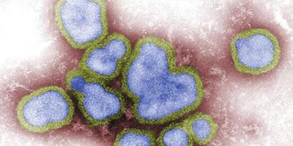 Avian influenza viruses. Digitallycolorized negative-stained transmission electron micrograph (TEM).