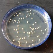 Bacterial colonies (mycobacteria) growing on artificial media in a petri plate.