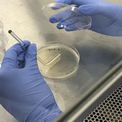 Spread plate procedure for quantitative culture Renibacterium salmoninarum