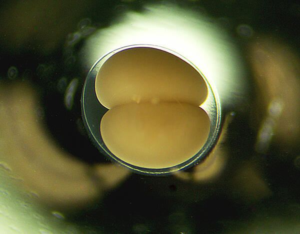 A Sea Lamprey egg viewed under a microscope