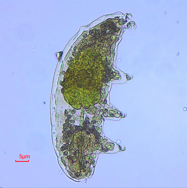 A green tardigrade is seen under a microscope against a blue background with a 5-micron length indicator.