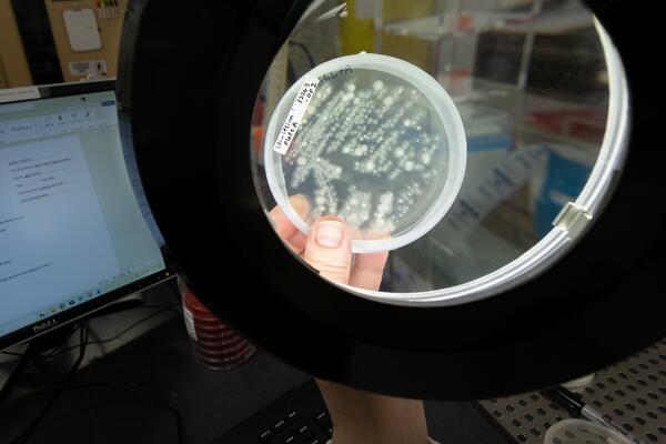 A scientist holds a petri dish under a light. Inside the dish are microorganisms taken from salamander skin.