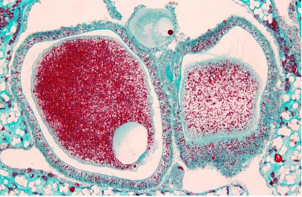 Microscopic stain of coral with blue and red colors denoting specific features