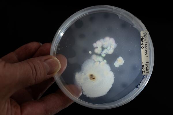 A scientist in a lab holding a salamander skin sample under a light for investigation.