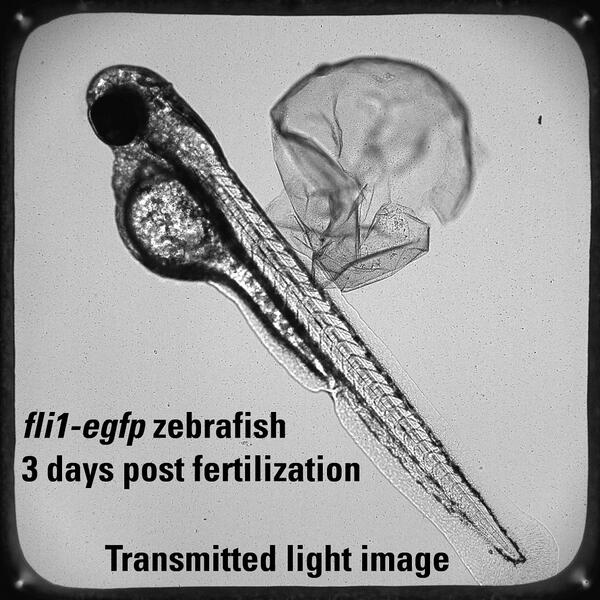 This is an example of a 72 hour post fertilization fli1:egfp zebrafish (3 millimeters long) imaged under transmitted light