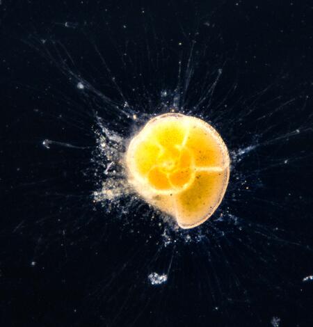 image of live foraminifera under microscope