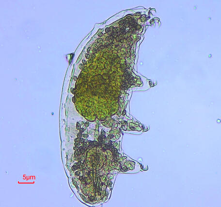 A green tardigrade is seen under a microscope against a blue background with a 5-micron length indicator.