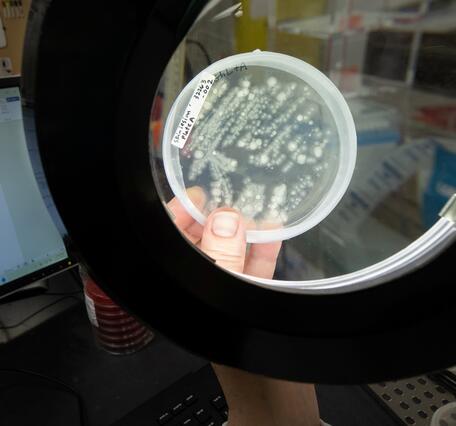 A scientist holds a petri dish under a light. Inside the dish are microorganisms taken from salamander skin.