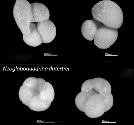 Photos of two foram species under a light microscope