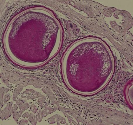 stained histology slide of heart tissue with 3 parasitic schizonts visualized as 3 encysted ovals in surrounding tissue.