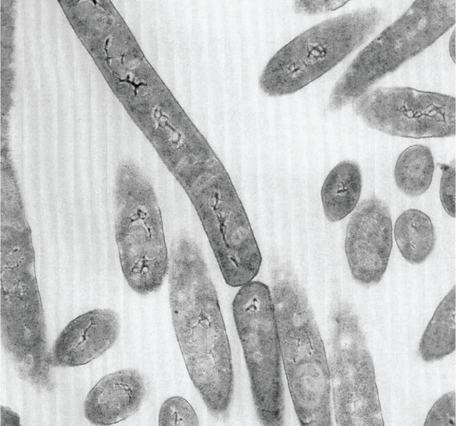 Black and white image of gray spaghetti-like filaments of bacteria on a white to light gray background