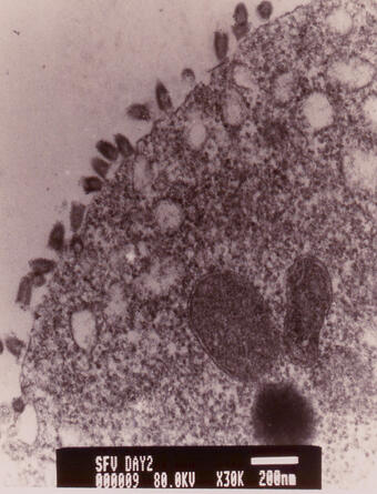 Bullet-shaped rhabdovirus particles