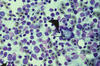 Plate 14, Figure 41, Proliferative kidney disease (PKD)