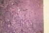 Plate 14, Figure 42, Proliferative kidney disease (PKD)