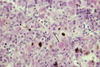 Plate 15, Figure 43, Proliferative kidney disease (PKD)