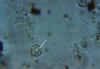 Plate 16, Figure 46, Chloromyxum majori