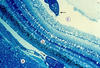 Plate 25, Figure 75, Diplostomum sp.
